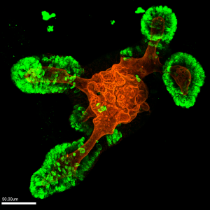 WT Organoid MIP_Ki67_RhPh_50um